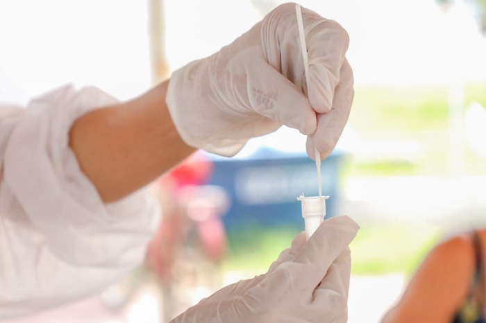 Secretaria de Saúde suspende testagem contra Covid-19 aos sábados