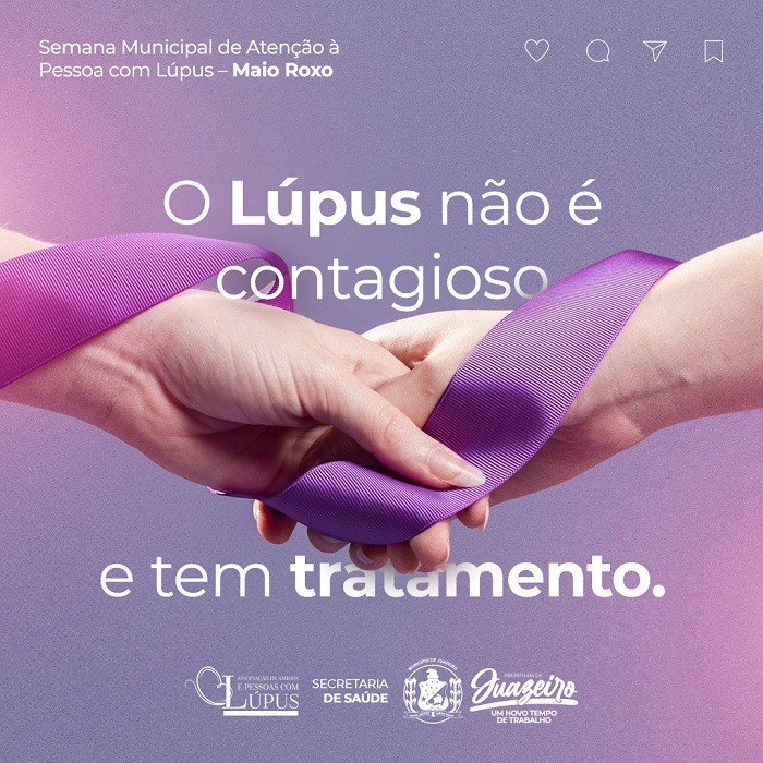 Prefeitura de Juazeiro promove Semana Municipal de Atenção à Pessoa com Lúpus