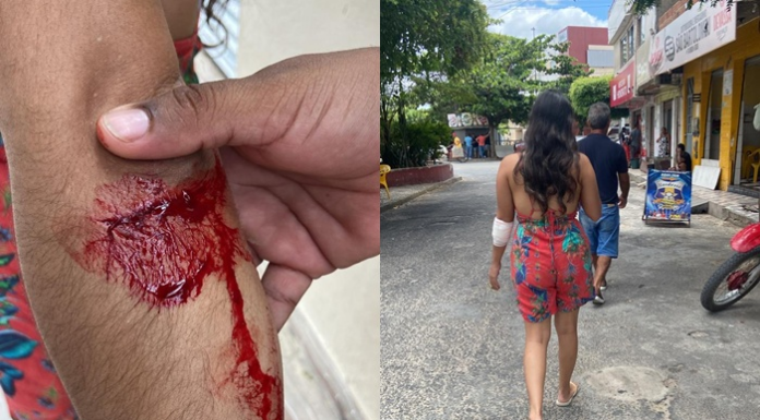 Vídeo: Cães vadios causam medo e atacam jovem no Condomínio Morada do Rio