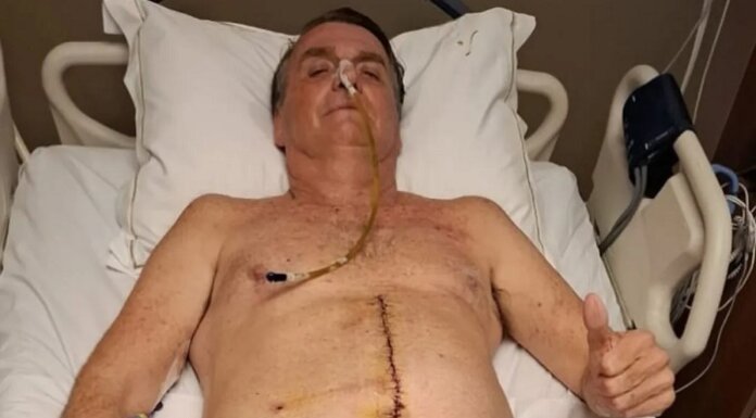 Justiça procura Bolsonaro na UTI para informar sobre julgamento